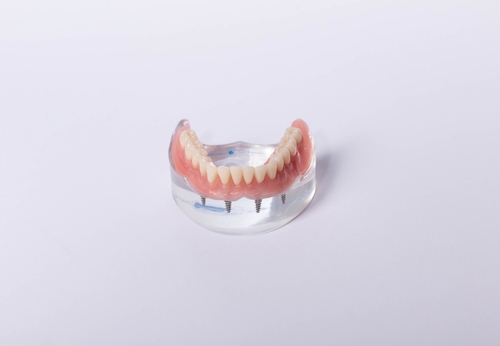 implant dentures Tewksbury, MA