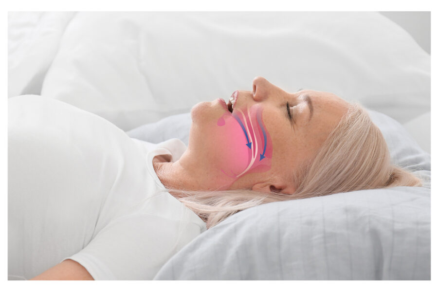 sleep apnea tewksbury ma