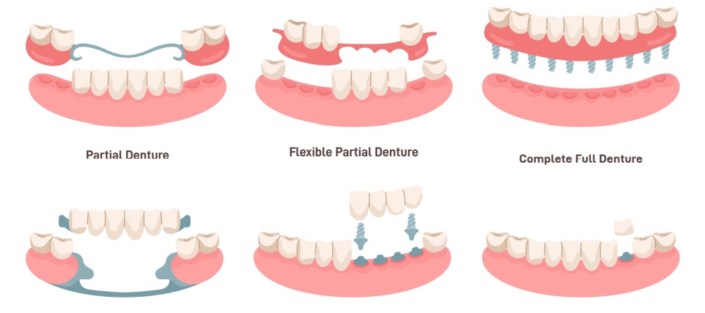 snap on dentures