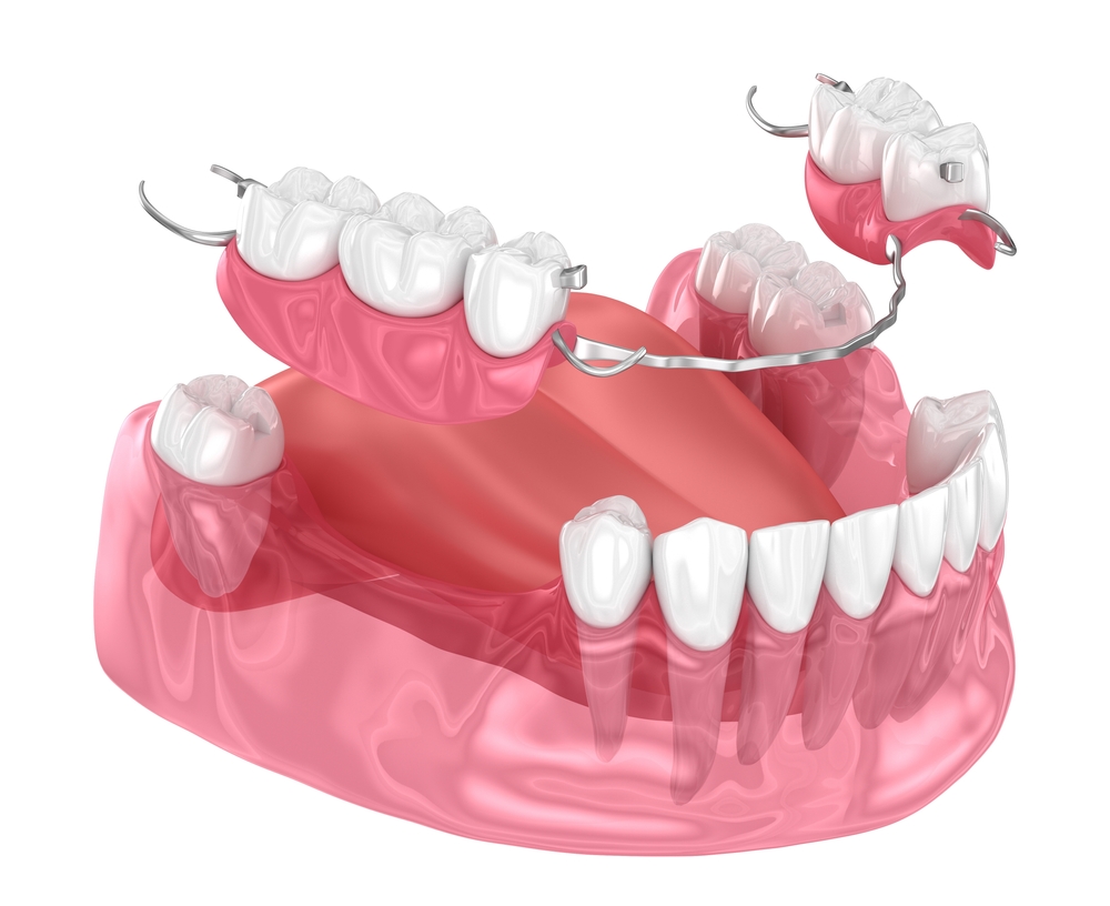 Partial Dentures in Tewksbury MA