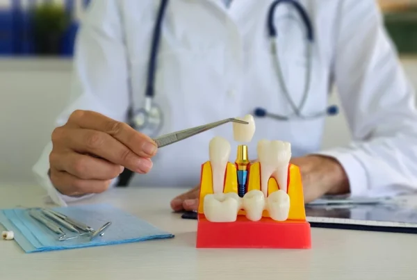 Benefits of Dental Implants in Tewksbury MA