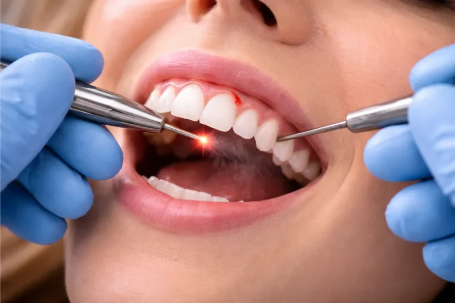 Is Gum Lengthening Cosmetic or Medically Necessary?