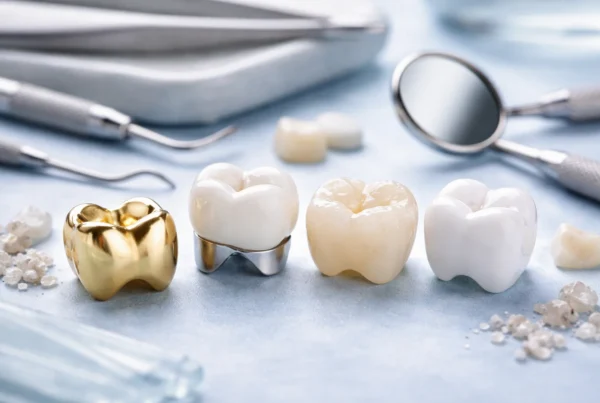 What Types of Dental Crowns Are There?